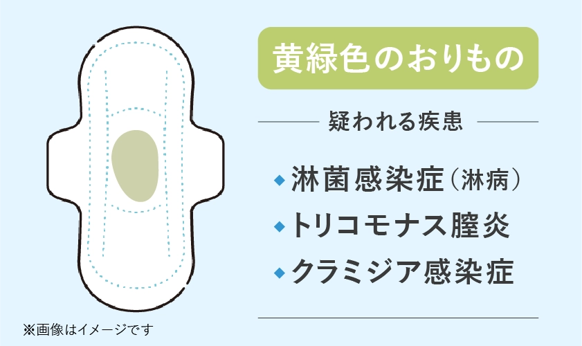 黄緑色のおりもので疑われる病気や性病