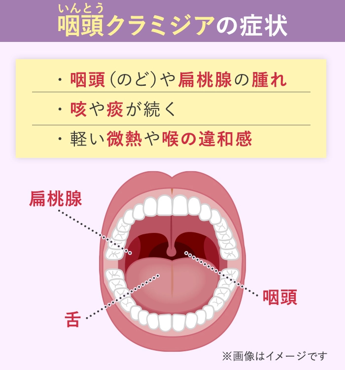 クラミジアは咽頭（喉）にも感染