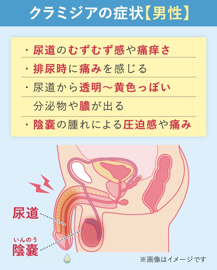 男性のクラミジアの症状