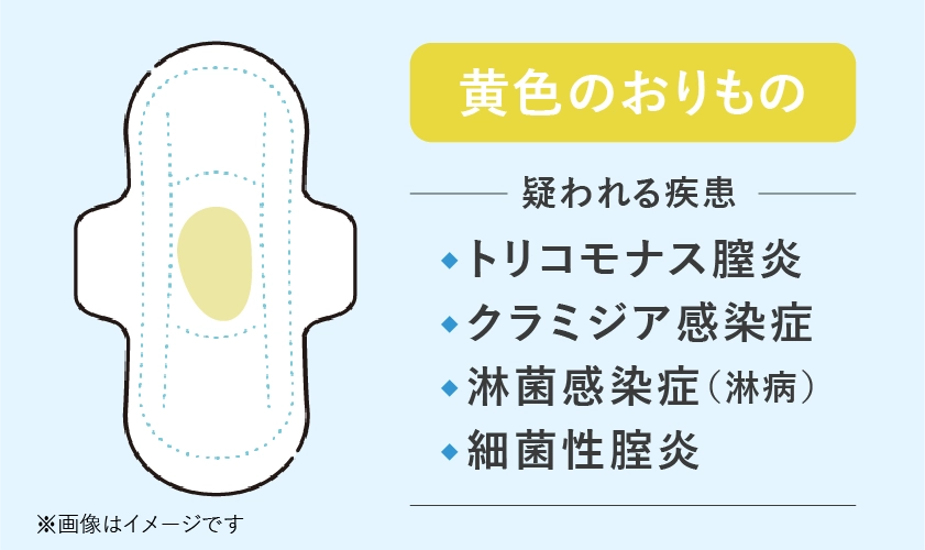 黄色いおりもので疑われる病気や性病