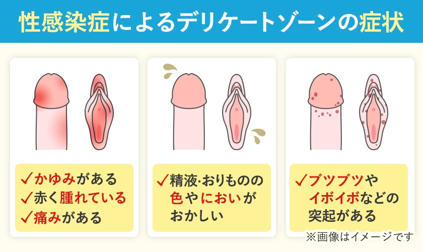 感染症によってデリケートゾーンにあらわれるかゆみなどの症状例