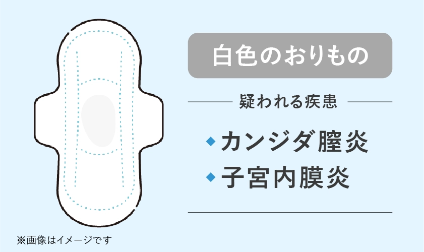 白色のおりもので疑われる病気や性病