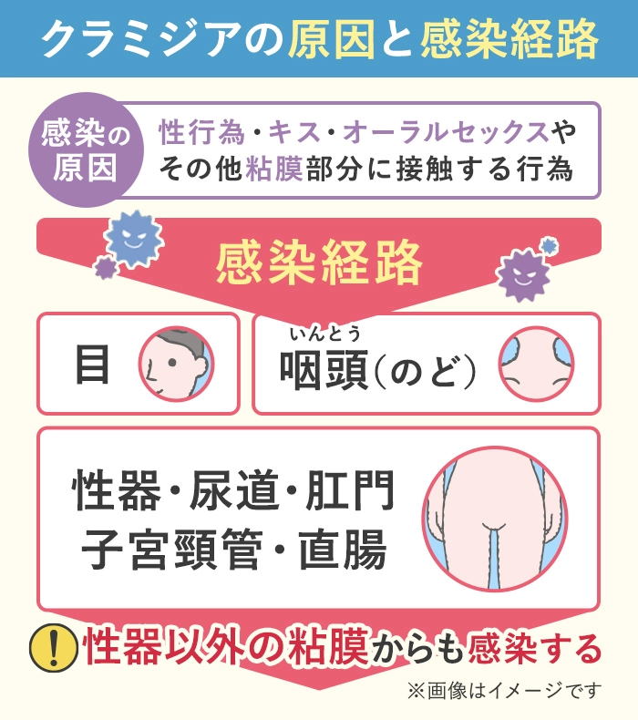 クラミジアの原因と感染経路