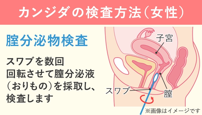 膣分泌物検査の方法