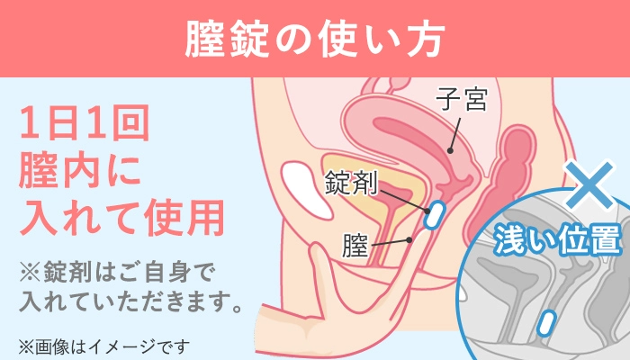 膣錠の使い方