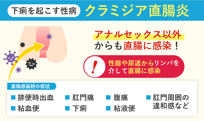 下痢を起こす性病クラミジア直腸炎