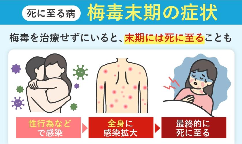 梅毒末期の症状