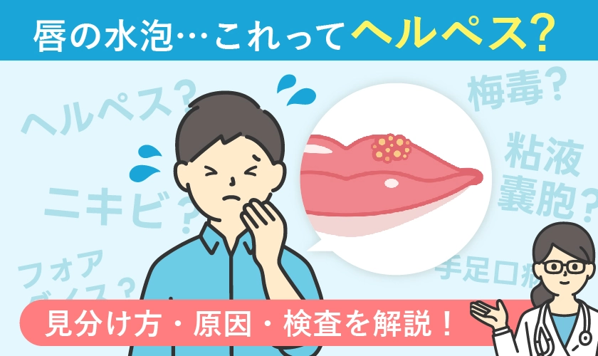 唇にできた水疱はヘルペス?