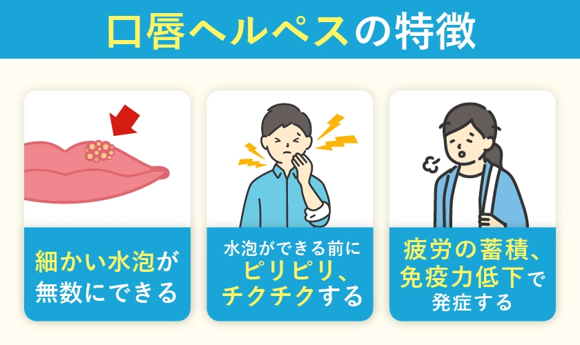 口唇ヘルペスの特徴