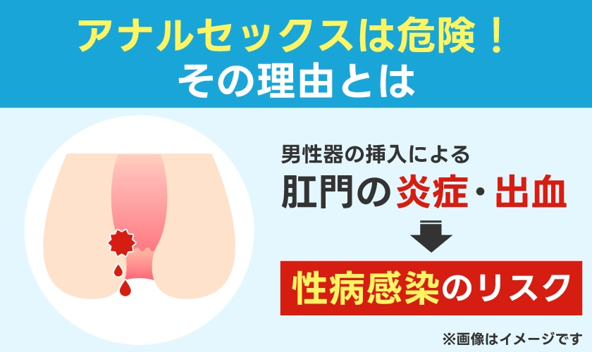 アナルセックスが危険な理由