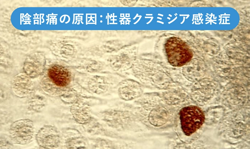 クラミジア感染症の原因菌のイメージ