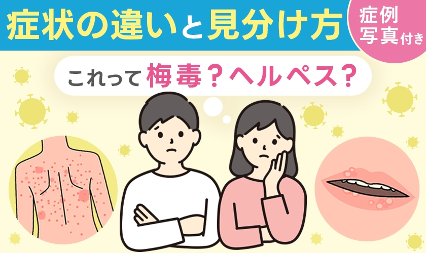 梅毒とヘルペスの見分け方