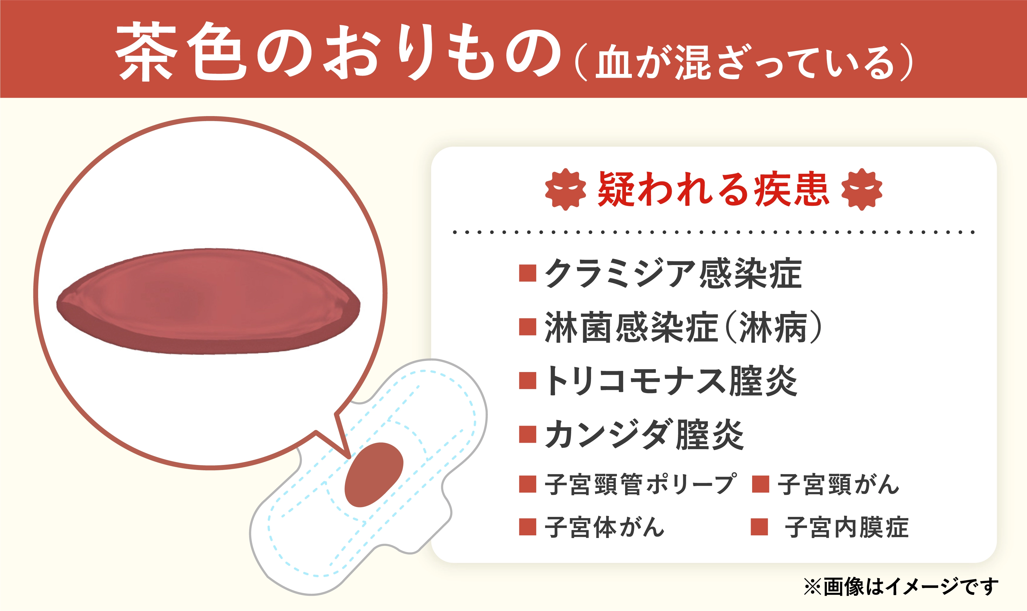 茶色のおりもので疑われる病気や性病