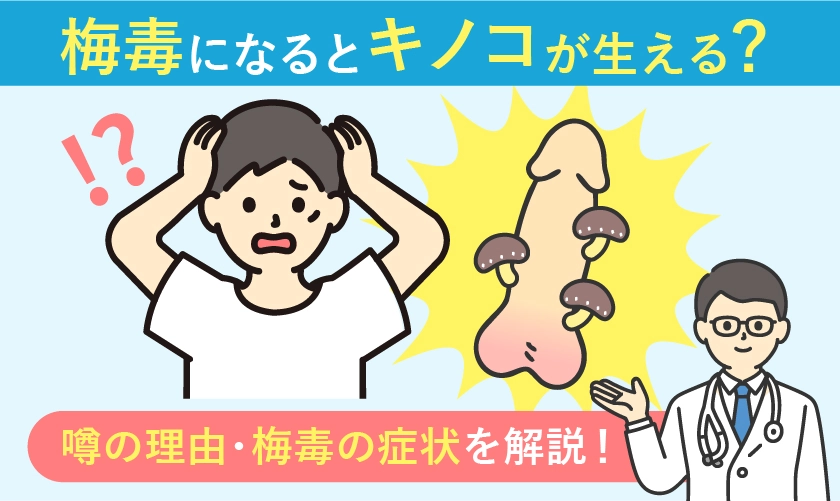 梅毒になるとキノコが生えるのか解説