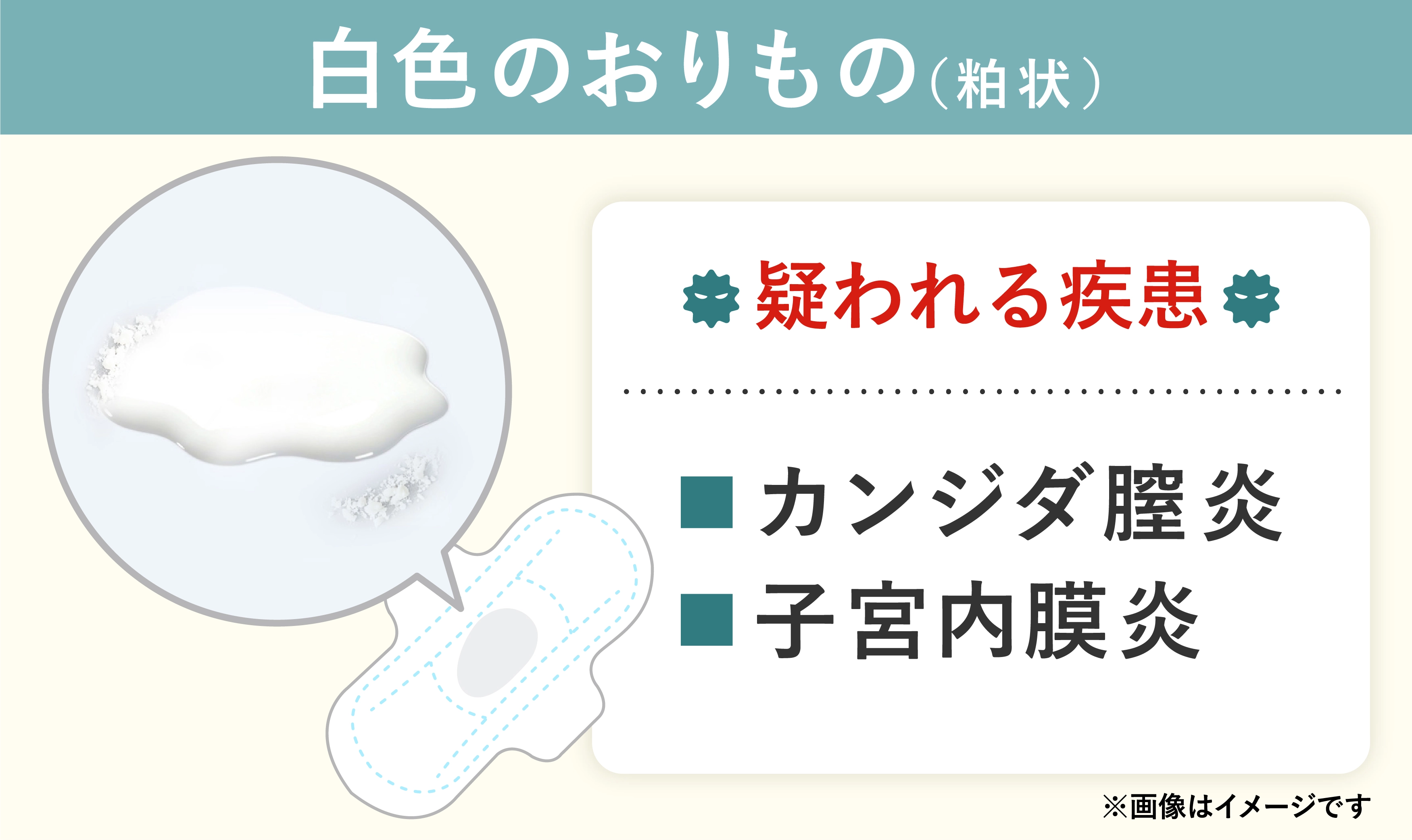 白色のおりもので疑われる病気や性病