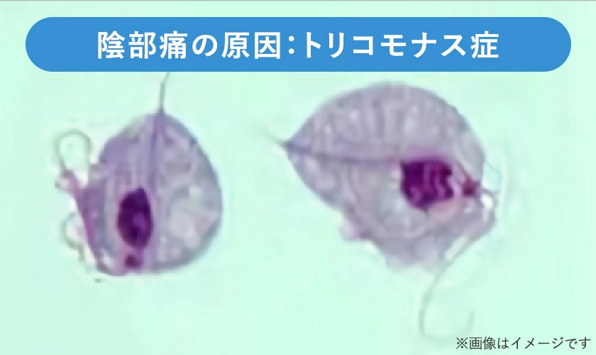 トリコモナス膣炎寄生虫の拡大写真