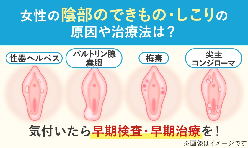陰部のできもの・しこりの原因や治療法は？