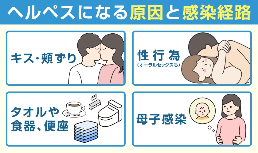 ヘルペスになる原因と感染経路