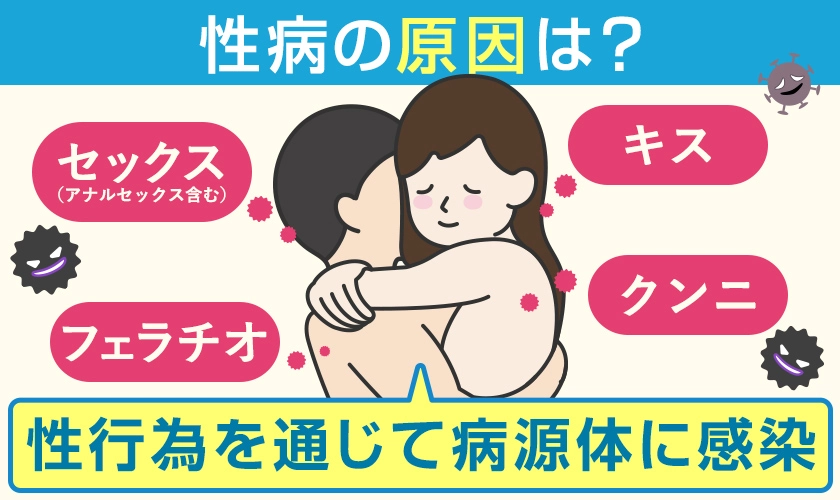 性病の原因は、性行為を通じて細菌・真菌・ウイルスの病源体に感染すること