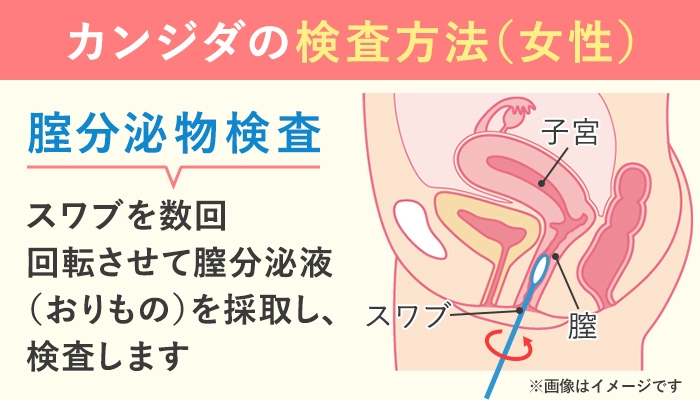 膣分泌物検査の方法