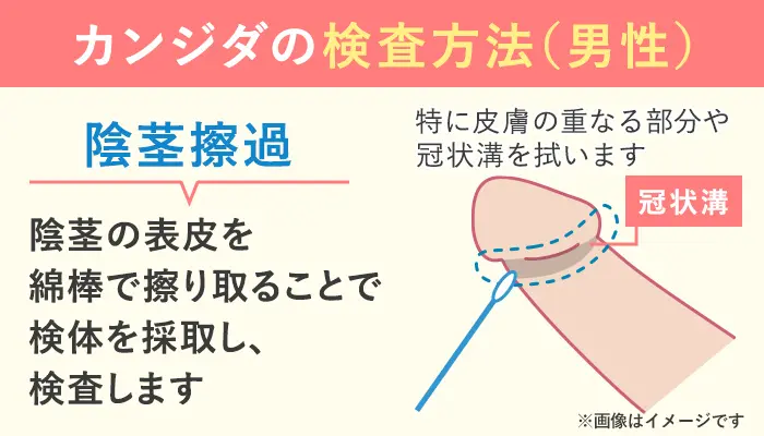 陰茎擦過検査の方法