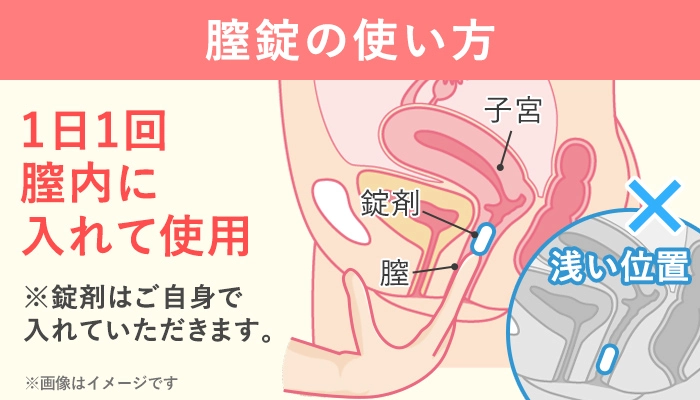 膣錠の使い方
