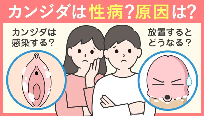 カンジダは性病?原因は? 放置するとどうなるの? カンジダは感染する?