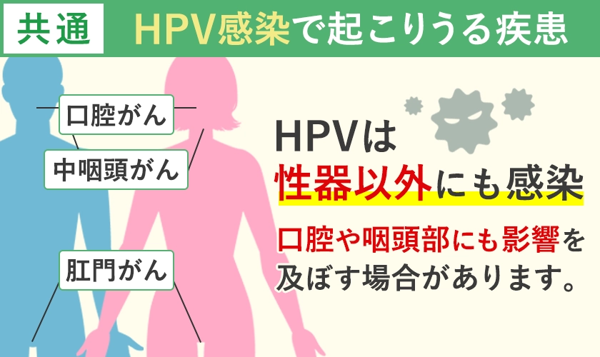 HPV感染による男女共通の疾患