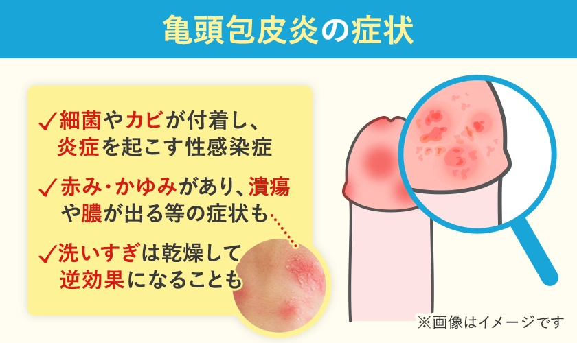 亀頭包皮炎の症状の一覧