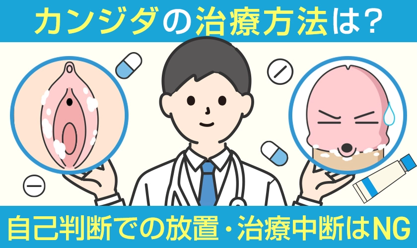 カンジダの治療方法は?自己判断での放置・治療中断はNG