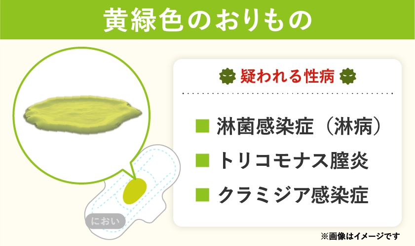 黄緑色のおりもので疑われる病気や性病