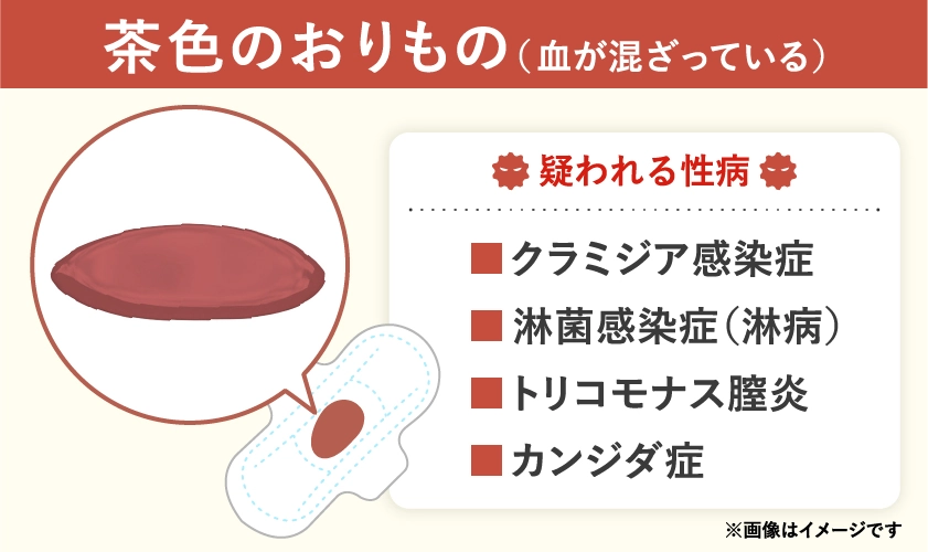 茶色のおりもので疑われる病気や性病