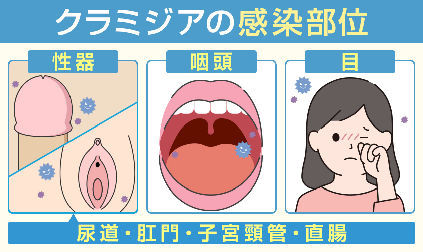 クラミジアの感染部位　性器・咽頭・目・尿道・肛門・子宮頚管・直腸