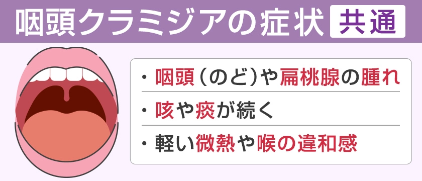 咽頭クラミジアの症状　男女共通　のどや扁桃腺の腫れ　咳や痰が続く