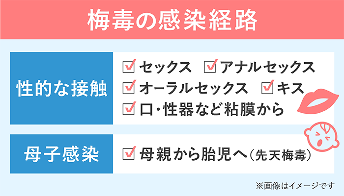 梅毒の感染経路はあらゆる性行為と母子感染