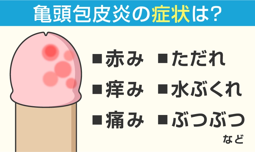 亀頭包皮炎の症状は？　赤み・痒み・痛み・ただれ・水ぶくれ・ぶつぶつ