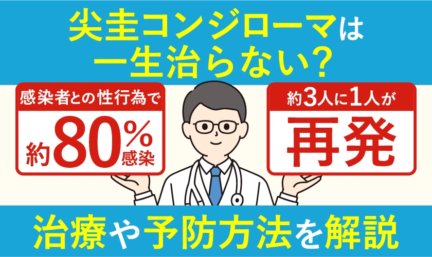 尖圭コンジローマは一生治らない？再発率や感染リスク、治療法・予防法（HPVワクチン・コンドーム）を解説