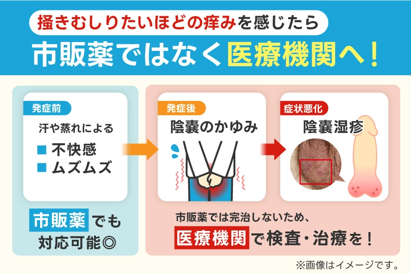 市販薬で対応可能な場合