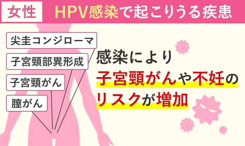 HPV感染による女性の疾患