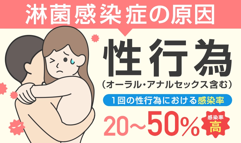 淋菌感染症（淋病）の原因は性行為（オーラルセックス・アナルセックスを含む）感染確率は20～50％と非常に高い