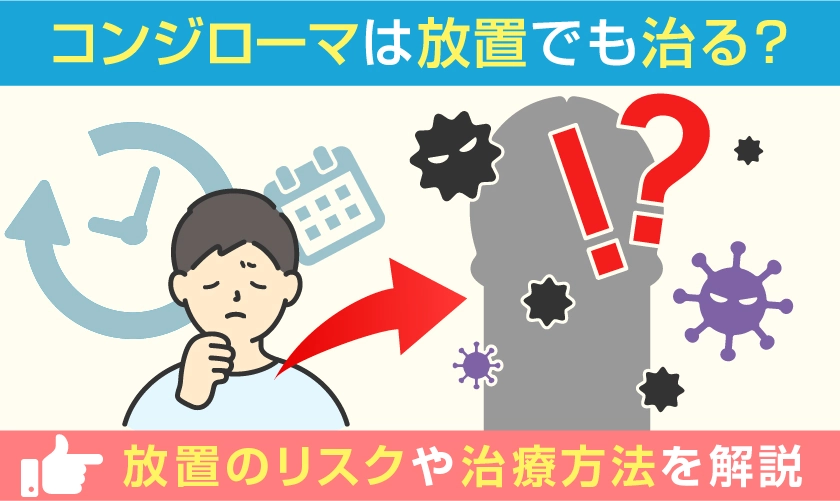 コンジローマは放置で治る？