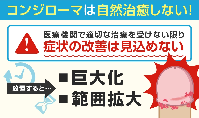 コンジローマは自然治癒しない