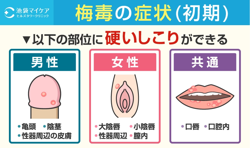 梅毒の初期症状