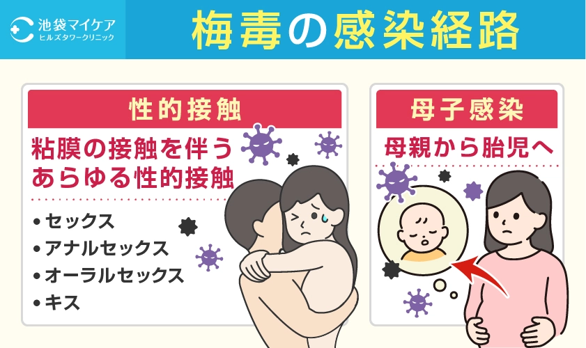 梅毒の感染経路