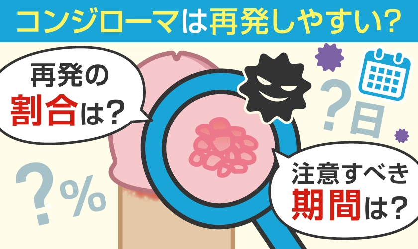 コンジローマは再発しやすい？
