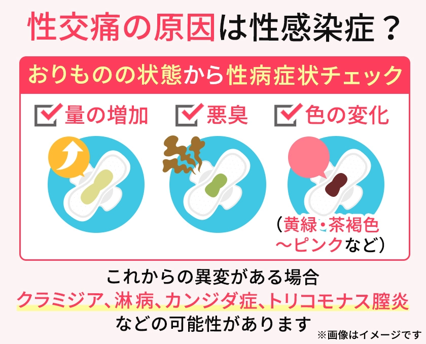 性交痛とおりもの異常を生じる性感染症の一覧