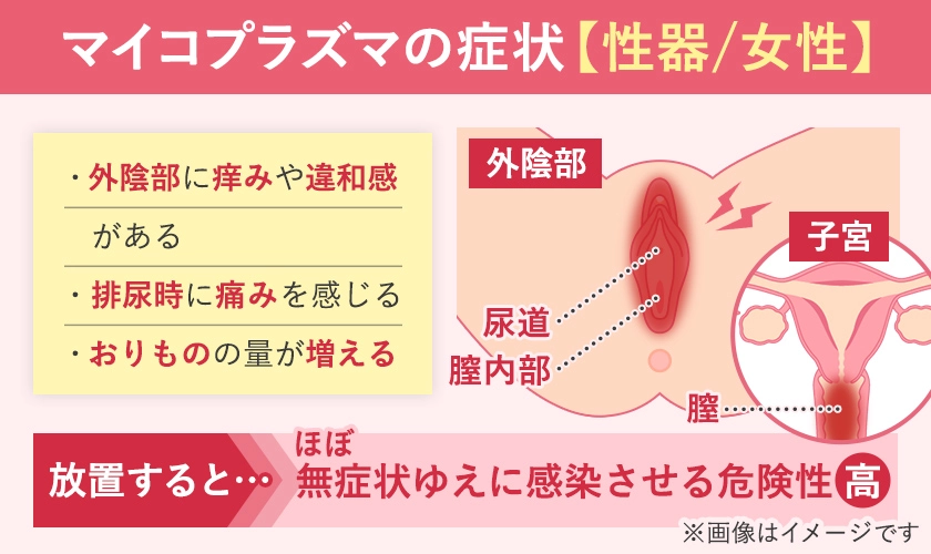 マイコプラズマ（性病）の女性の症状と発生部位