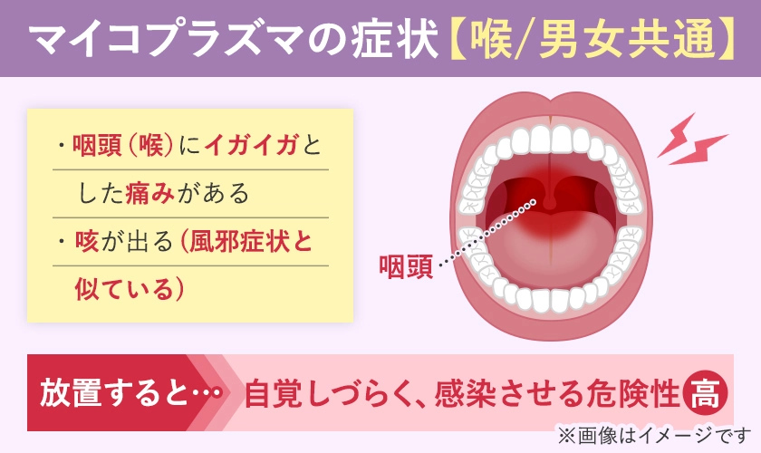 マイコプラズマ（性病）の喉に生じる男女共通の症状