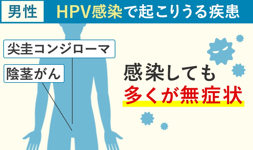 HPV感染による男性の疾患